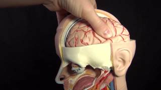 Increased ICP (Intracranial Pressure) Nursing Care Animation