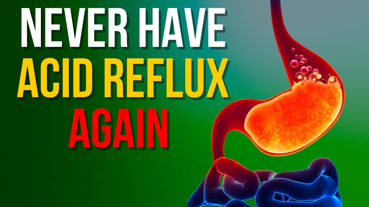 How To Never Have To Suffer From ACID REFLUX Again YouTube
