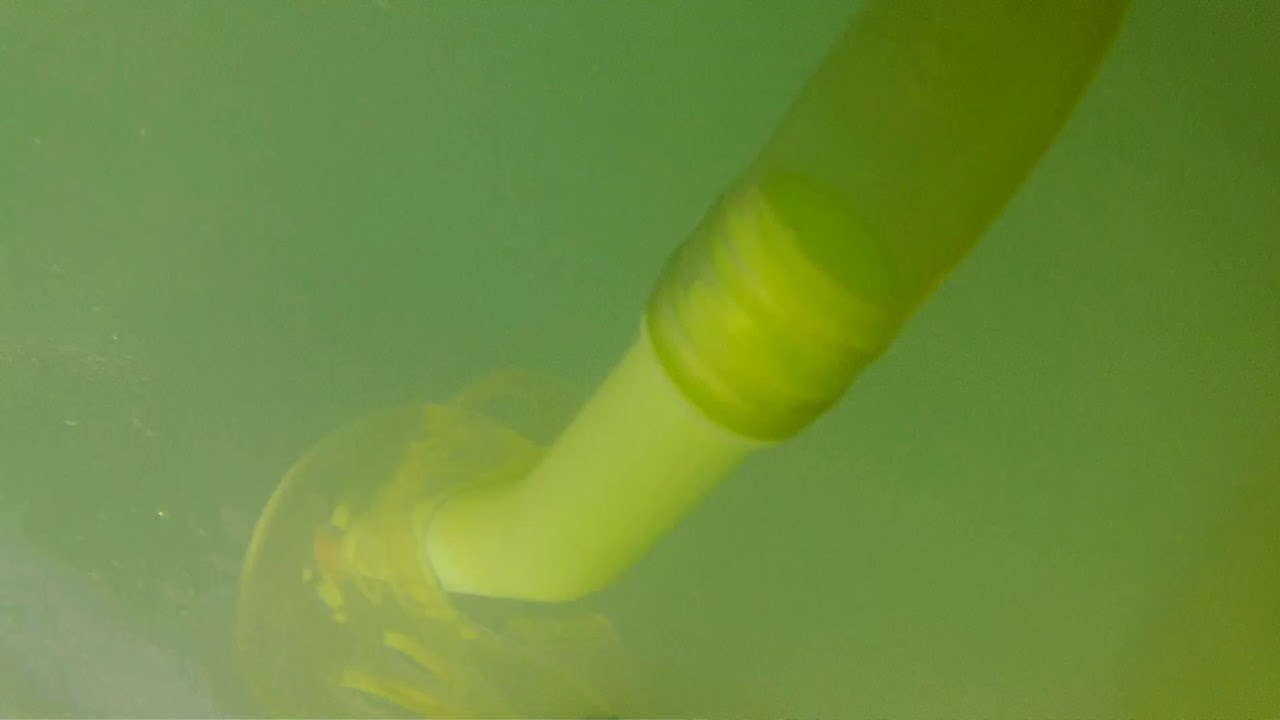 Ataque de medusas en playa San jose ( Almería)