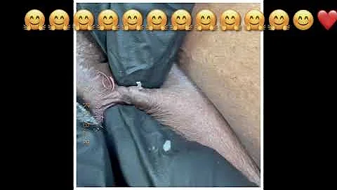 Another big blackhead extraction