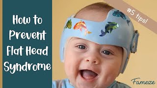 Famous How to Prevent Flat Head Syndrome In Your Baby (5 Tips!) Net Worth