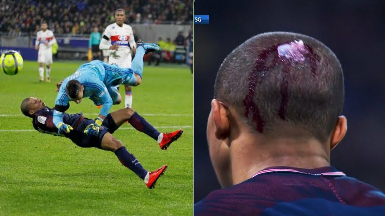 Horror Tackles on Kylian Mbappe | Mbappe injury head | #mbappe # ...