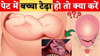 पेट में बच्चा टेढ़ा हो तो क्या करें  - Transverse Baby in womb in Hindi - Youtube mom