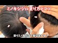 ミノキシジルの塗り方とコツ💡塗りミノ夜1回だけで薄毛は治せるのか？