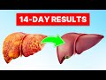 MIRACLE Drink Eliminates 50% of Liver Fat in Just 2 WEEKS!