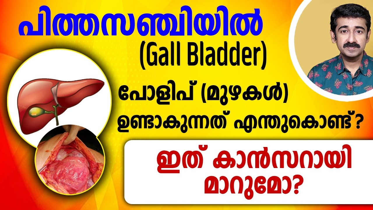 Почему в желчном пузыре образуются полипы (опухоли)? Могут ли они переродиться в рак?