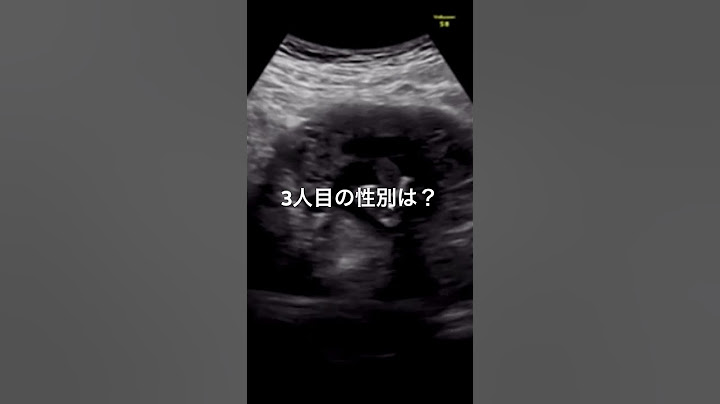 20週目でついに性別が！