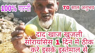 दद खज खजल सरयसस 1 दन म ठक कर, इसक इसतमल स और फर जनदग भर नह