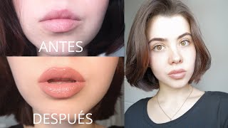 Los como naturalmente hincharse labios