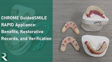 CHROME GuidedSMILE RAPID Appliance: Basics, Restorative Records, and Verification