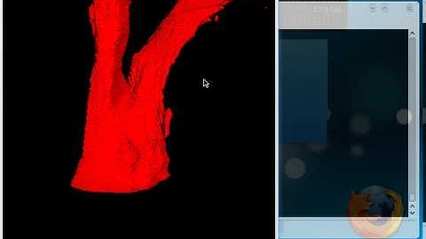 CBCT Volumetric Airway Segmentation and Surfacing result