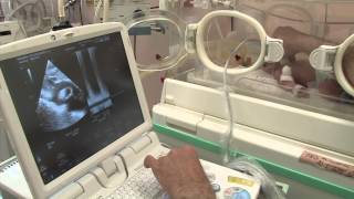 Neonatal Transport
