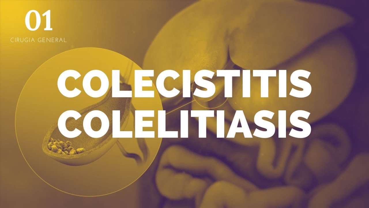 Colecistitis y Colelitiasis - ENARM