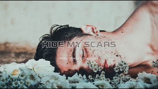 FREE| Sad Pop x Tate McRae Type Beat 2022 "Hide My Scars" Pop Instrumental