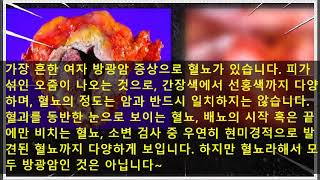 여자 방광암 증상 개선할수 있어요