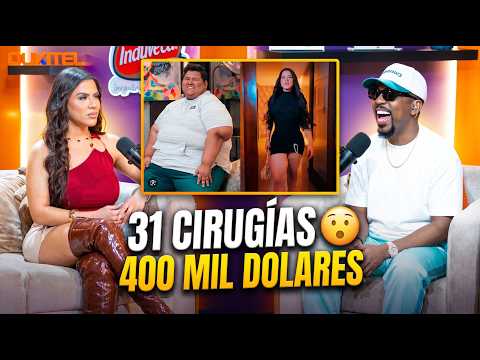 31 SURGERIES AND 400 THOUSAND DOLLARS 😮 LA MICHA ❌ EL DOTOL NASTRA⚡ALOFOKE RADIO