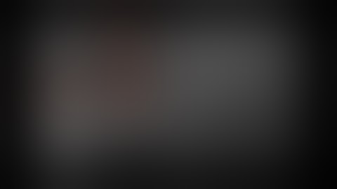 GIST: Lap Excision: Dhaval Mangukiya