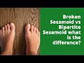 Broken Sesamoid vs Bipartite Sesamoid what is the difference?