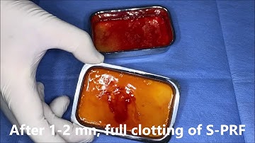 S-PRF XL sticky bone