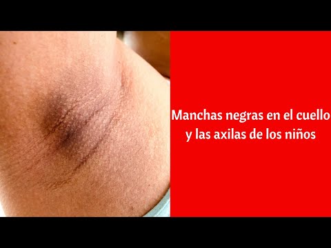 Video: Cómo Limpiar El Cuello De Piel