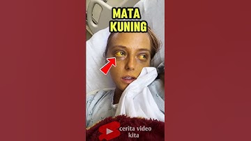 Segera Berobat Jika Mata Berubah Jadi Kuning #shorts #shortvideo #viralshorts