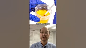 Most Common Tests For Kidney Function On Blood Work!