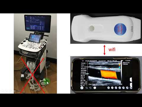 Мобільна ехографія.   Українсько французький інноваційний проект.