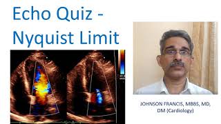 Echo Quiz - Nyquist Limit