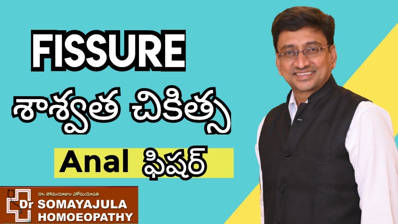 FISSURE Best Homeo Medicine / How to Reduce Fissure naturally Telugu / Dr Somayajula