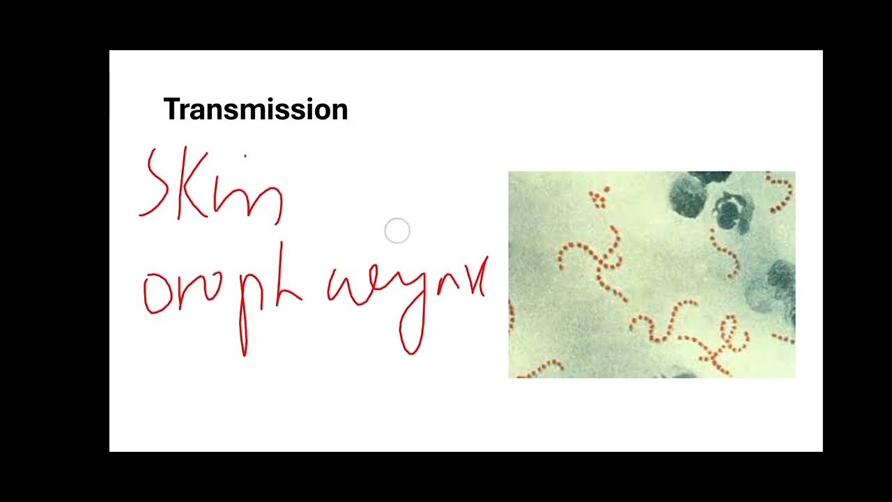 Streptococcus Pyogens [complete lecture] #microbiology #mbbs #micro # ...