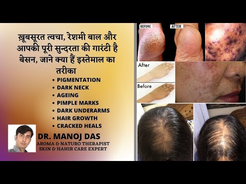 5 NATURAL BEAUTY HACKS WITH BESAN FOR THE FLAWLESS SKIN AND SHINY HAIR I DR. MANOJ DAS