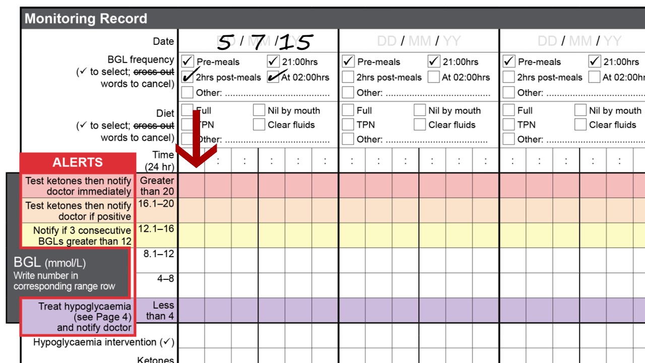 Insulin Amount Chart