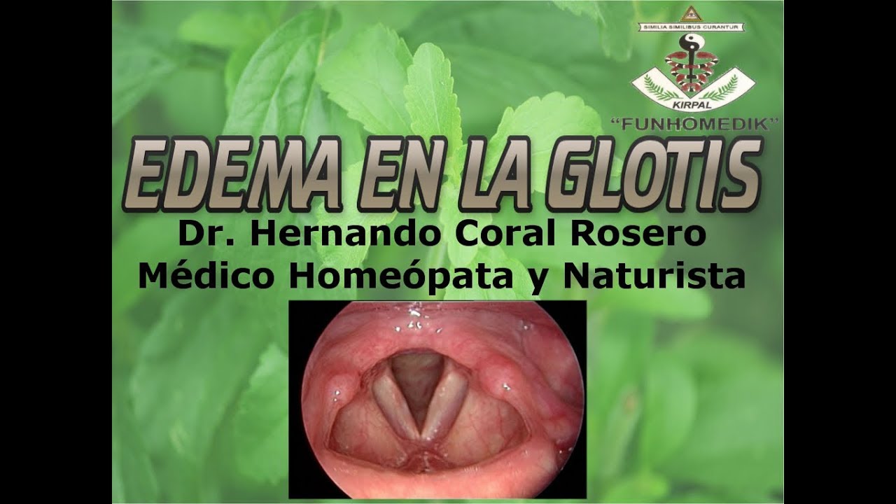Es de que glotis edema una