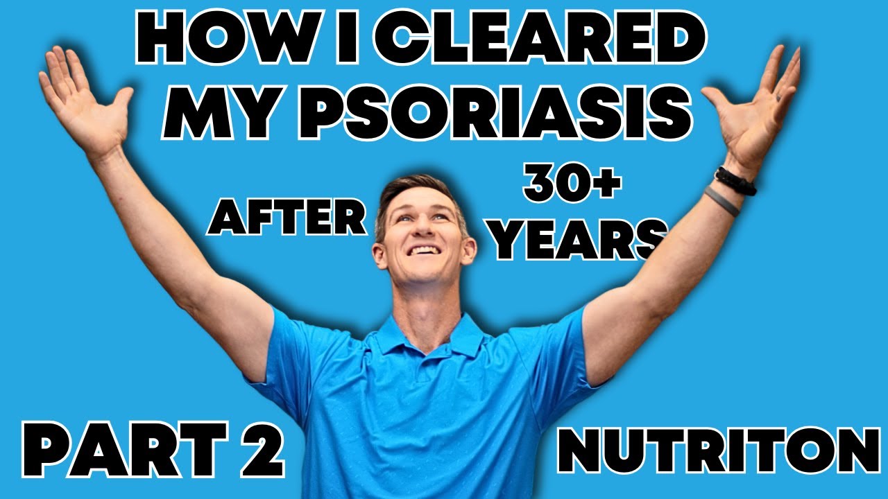 My Journey to Conquering Psoriasis | What I ate to Heal my Skin