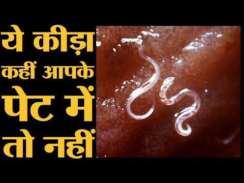 बच्चे का 22 लीटर खून पी गया ये कीड़ा l the Lallantop