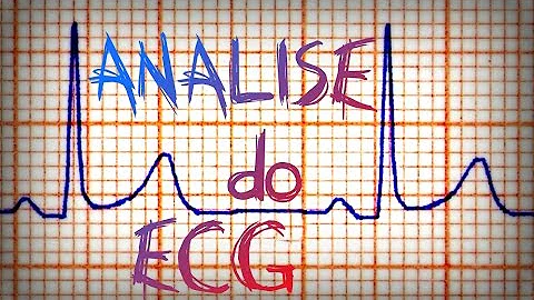 Qual é a sensação de uma palpitação?