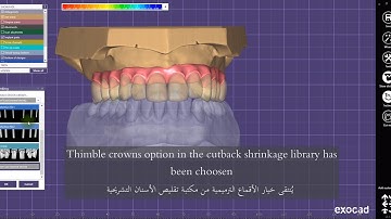How to use Cutback Shrinkage Library (Thimble Crowns) for All on X implants bridge design in exocad