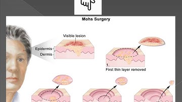 Coding tips for Skin system(MOHS)