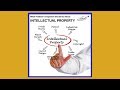 How and Why Aviation Sales and Marketing People Should Protect Their Intellectual Property