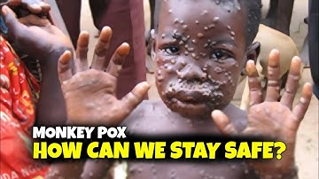 What You Need to Know About Monkeypox | Symptoms, Prevention, and Treatment