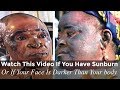 Watch This Video If You Have Sunburn Or If Your Face Is Darker Than Your Body