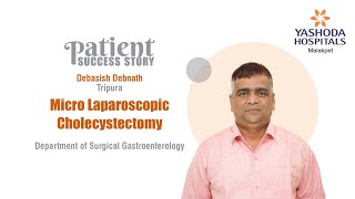 Micro Laparoscopic Cholecystectomy | Yashoda Hospitals Hyderabad