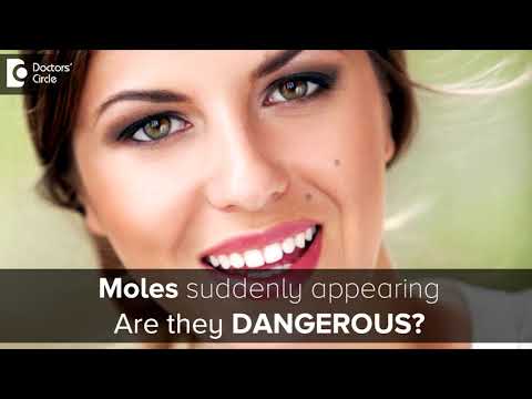 WHAT CAUSES MOLES
