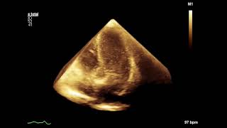 60 Seconds Echo Tavi