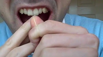 Bad Breath Cures - How To Cure Bad Breath By Flossing