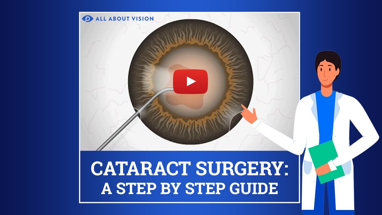 What To Expect During And After Cataract Surgery Youtube