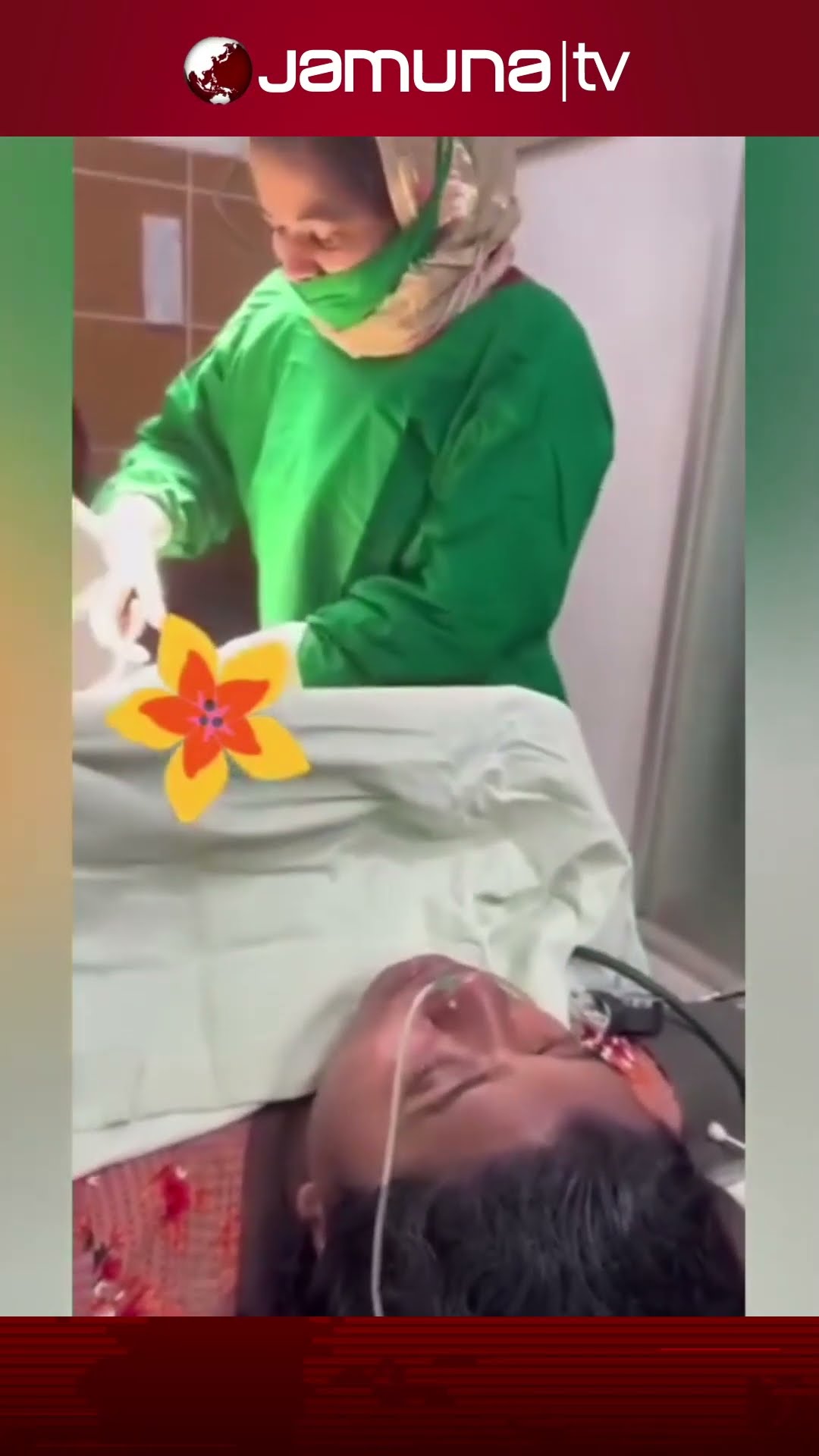 ব্রাহ্মণবাড়িয়ায় অপারেশনের সময় এক প্রসূতি মা গান গাইলেন #brahmanbaria #hospital #song #jamunatv