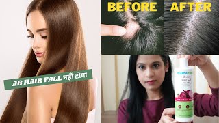 NO MORE HAIR FALL | BEST HAIR FALL SOLUTION |AB AASANI SE HAIR FALL CONTROL KARE |  BY MOMMY TALKIES