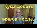 Гирудотерапия для чайников 3 # Куда девать пиявок после сеанса