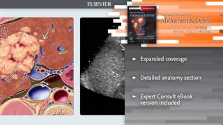 Diagnostic Ultrasound: Abdomen and Pelvis